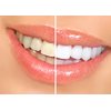Dr. George's Dental Whitening Gel with Instructions