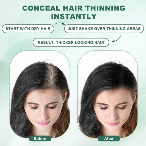 Hair Fibers (28g), Hair Fibers for Thinning Hair, Hair Building Fibers, Hairpiece Filler, Increase Hair Density, Styling Powder for Women & Men, Hair Makeup, Premium Formula Thickening (BLACK)