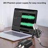 Aokeo 1-Channel 48V Phantom Power Supply with Adapter, Bonus+XLR 3 Pin Microphone Cable for Any Condenser Microphone Music Recording Equipment