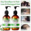 Rosemary Shampoo and Conditioner Set, Hair Growth Shampoo and Conditioner for Anti Hair Loss Nourishing Scalp Reduce Frizz, Rosemary Mint Shampoo and Conditioner for Women Men, Sulfate & Paraben Free