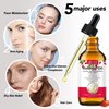 SOLOTREE Rosehip Oil for Face, Skin Moisturizer Rosehip Oil, Nourishing Hair Care, Rosehip Oil For All Skin & Hair Types 2.02 FL.OZ