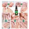 Ginger Nail Treatment Nail Support Nail Care, 7days Nail Treatment, Ginger Nail Growth Serum, Ginger Cuticle Care Oil for Nails,Cuticle Serum for Nails (2Pcs, 1 Fl.oz(pack of 1))