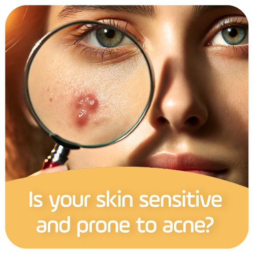 Asepxia Deep Cleansing Gentle Care Acne Treatment Hypoallergenic Bar Soap with Salicylic Acid, 4 Ounce