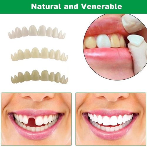 Tooth Repair Kit，Temporary Natural Shade Fake Teeth for Filling The Gap, Moldable Fake Teeth and Thermal Beads Replacement Kit Replace The Missing or Broken Tooth