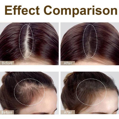 Hairline Powder for Women - Dark Brown Root Touch Up, Conceals Thinning Hair and Bald Spots, Waterproof Volumizing Hair Filler