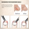 FERYES Toenail Clipper Straight Blade for Ingrown and Thick Nails - Stainless Steel and Sharp Pointed Tip Ingrown Nail Clipper – Wide Jaw Toe Nail Cutter Podiatry Tool