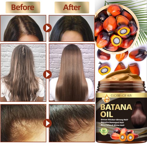 Batana Oil and 2 Pack Ginger Hair Regrowth Shampoo Bar,Natural Raw Batana Oil for Hair Growth Hair Mask Ginger Bar Shampoo,Promotes Hair Growth,Nourishes Scalp,Repair & Strengthen Dry Damaged Hair