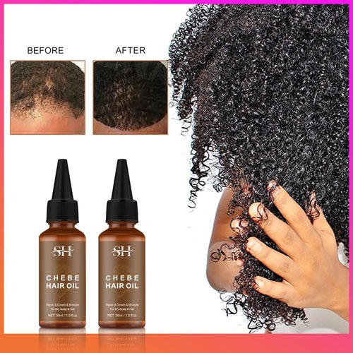 100% Natural Chebe Hair Oil-gowwim Chebe Oil for Hair Growth,Made with Authentic Chebe Powder From Chad,Hair Loss Treatment,Relieves Itchy Scalp & Promotes Hair Growth.