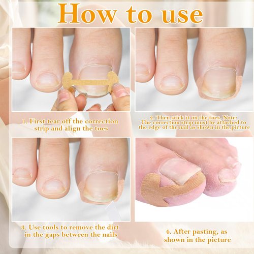 105 pcs Ingrown Toenail Removal Kit Ingrown Toenail Pedicure Tools with Ingrown Toenail Sticker, Toenail Clippers, Toenail File, Toenail C-type Tube