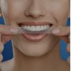 Crest 3D White Professional Effects Whitestrips Teeth Whitening Strips Kit, 40 Strips (20 Count Pack)