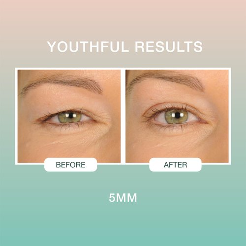 Contours Rx Lids By Design - Non-Surgical & Invisible Eyelid Lift Strips - For a More Youthful-Looking Appearance, Reshape and Define with Eyelid Tape for Hooded Eyes (5mm) 80ct