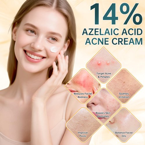 Azelaic Acid 14% for Face, Premium Acne Cream Reduces Dark Spots & Facial Redness, Azelaic Acid Serum with Salicylic Acid & Niacinamide for Acne Breakouts, Oil Control & Relieve Irritation, 2 Oz