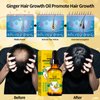 Batana Oil for Hair Growth,Organic Raw Batana Oil Hair Mask & Ginger Hair Growth Oil,Hair Oil Hair Treatment for Frizzy Damaged Hair,For Thicker-Strong Hair,Nourishes Scalp,Repair Dry Damaged Hair