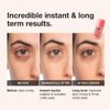 NAPH iNNBEAUTY PROJECT Bright & Tight Dark Circle Firming Eye Cream with Vitamin C & Peptides (0.5 oz / 15 mL) + Bonus Acne Patch (36 Pieces)