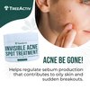 TreeActiv Invisible Salicylic Acid Cystic Acne Treatment For Face Original Formula, 0.5 fl oz, Acne Face Cream, Acne Spot Treatment for Face & Body, Acne Clearing Cream Moisturizer for Teens & Adults