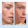 First Aid Beauty Ultra Repair Cream Intense Hydration Moisturizer for Face and Body – Rich Whipped Texture Strengthens Skin Barrier + Instantly Relieves Dry, Distressed Skin + Eczema – 6 oz
