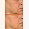 Dr. Dennis Gross Vitamin C Lactic 15% Vitamin C Firm & Brighten Serum: Visibly Improve Signs of Aging, 1 oz