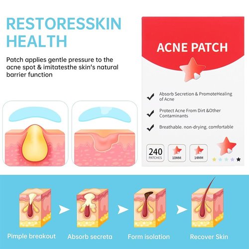 Waspot Pimple Patches for Face, Cute Star Zit Covers, Stars Hydrocolloid Acne Patch, For Sensitive Skin, with Tea Tree, Salicylic Acid & Cica Oil (10&12&14mm) 240 Count