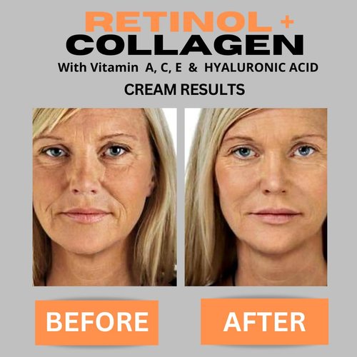 Retinol + Collagen, Hyaluronic Acid, Vitamin C Anti-Aging Face Cream, Day and Night Moisturizing Cream, Anti-Wrinkle Cream for Face, Firming Cream - 4oz