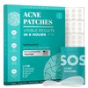 Pimple Patches (Made in Korea) for Face & Body - Overnight Treatment - Acne Patch for Zits, Bumps, Spots, Pimples, Whiteheads - Hydrocolloid Stickers - Vegan, Cruelty-Free, Hypoallergenic (10mm)
