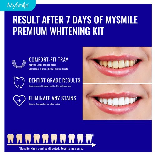 MySmile 7 Treatments Prefilled Teeth Whitening Trays Kit with 12% Hydrogen Peroxide Whiter Gel for Sensitive Tooth, Fast-Result Vegan Teeth Whitener Tooth Stain Remover, Mint Flavor