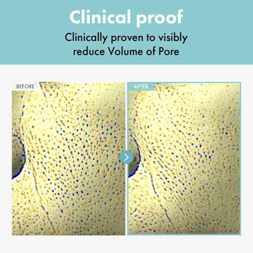 TOSOWOONG Pore Refiner Cream, Face Cream, Pore Extractor, Pore Minimize & Reducer and Remover. Best Pore Minimizer Treatment. Moisturizer for Oily Skin. K Beauty, Korean Skincare, 50g, 1.76 oz.