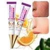 Dark Spot Remover for Face, Niacinamide Freckle Remover Cream for Body, 2 PCS Moisturizing Serum for Skin, Quick Effect to Repair Freckles Melasma Brown Spot.