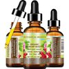 Botanical Beauty ORGANIC ROSEHIP SEED OIL Pure For Face, Skin, Hair and Body. Anti-Aging Moisturizer Facial Oil 2 Fl oz 60 ml