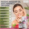 Advanced Clinicals Rosehip Oil For Face | Anti Wrinkle Facial Skin Care Serum | Vitamin C Serum Moisturizer Face Oil W/Vitamin E For Fine Lines, Dark Spots, Uneven Skin Tone, & Sun Damage, 1.8 Fl Oz