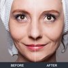 Cold Ice Face Mask Pack - Eye Cooling Gel Bead Mask for Puffy Eyes, Sinuses, Migraine Headache Relief, Dark Circles, Dry Eye - Adjustable, Reusable