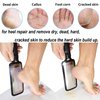 Angel Kiss Colossal Foot File Scraper Pedicure File - Premium Stainless Steel Foot Rasp, Dead Skin Callus Remover for Feet, Gentle Foot Scrubber, Pedicure Tools for Salon-Quality Foot Care - Black