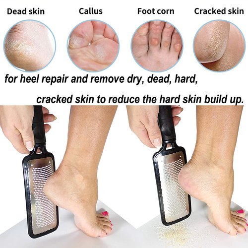 Angel Kiss Colossal Foot File Scraper Pedicure File - Premium Stainless Steel Foot Rasp, Dead Skin Callus Remover for Feet, Gentle Foot Scrubber, Pedicure Tools for Salon-Quality Foot Care - Black