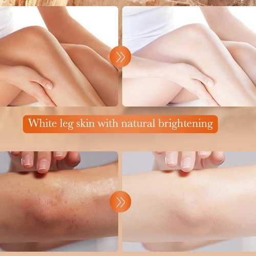 5.2oz Dark Knuckle Whitening Cream,Skin Body Bleaching For Dark Knees and Elbows,Moisturizing Strong Joint Whitening Cream for Clavicle,Neck,Niacinamide Vitamin C Dark Spot Corrector Remover