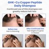 PeptideLabz GHK-Cu Copper Peptide Shampoo - Anti Hair Loss Shampoo - Promotes New Hair Growth, Blue