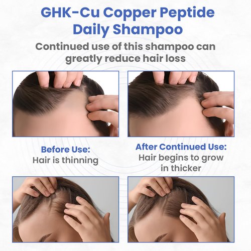 PeptideLabz GHK-Cu Copper Peptide Shampoo - Anti Hair Loss Shampoo - Promotes New Hair Growth, Blue