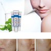 BioAqua Face Skin Care Acne Treatment Removal Scar Blemish Marks Cream