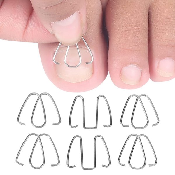 Ingrown Toe Wire Fixer, Nail Corrector Ingrown Tool Brace for Nail Toe Straighteners Braces Foot Care Men Women