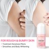 Strawberry Legs Treatment For Women,Bump Eraser Body Scrub, Keratosis Pilaris Treatment,Rough Bumpy Body Cream, Bump Eraser Body Scrub,Smoothing & Buffing Body Scrub Body Care