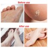 Paddsun 6Pcs Foot File Callus Remover Replacement Blades Pedicure Rasp Detachable Foot Scrubber Hard Skin Remove Stainless Steel Big Hole for Wet and Dry Feet