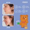 ONSOI 150 Blemish Patch - Hydrocolloid Pimple Patches for Face, Acne Spot Treatment-Cica