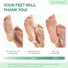 PLANTIFIQUE Foot Peeling Mask - Peeling Foot Mask Dermatologically Tested Repairs Heels & Removes Dry Dead Skin for Baby Soft Feet - Exfoliating Foot Peel Mask for Dry Cracked Feet (Jasmine 2 pack)