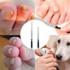 TDGBIH 2 PCS Toe Nail Files for Thick Nails Robust Stainless Steel Nail File Fingernail Files with Anti-Slip Handle 4 Sides,Nail Files for Men Seniors & Dogs