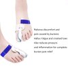 Askilt Bunion Corrector, Bunion Splints and Bunion Relief for Hallux Valgus, Big Toe Joint,Adjustable Bunion Splint Protector Sleeves kit F or Women and Men,7 pcs