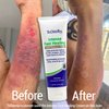TriDerma Intense Fast Skin Healing Cream for Hard-to-Heal Skin Irritations, Sores, Rashes, Dry, Cracked Hands, Cuts, Chafing, Burns, Scrapes - First Aid Kit Essential - FSA Eligible - 4.0 oz Tube