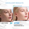 Hicream Hyaluronic Acid Serum for Face,100% Pure Anti Aging Serum Intense Hydration Moisture for Fine Lines, Wrinkle Reducing and Brightening Serum (Pro Formula) 1oz
