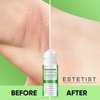 Estetist Razor Bump Stopper For Sensitive Skin - Ingrown Hair Treatment For Face, Underarm, Bikini Area, Legs, After Shave Roll On Moisturizer Serum with Aloe Vera, Tea Tree, Salicylic & Glycolic Acid