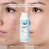 Cystic Acne Spot Treatment for Face: Cystic Hormonal Acne Spot Treatment for Face - Hormonal Acne Pimple Spot Cream with Salicylic Acid & Tea Tree Oil - 100 ml
