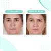 Serious Skincare Glycolic Extreme Skin Renewal Face Cream & Serum Set - Resurfacing Glycolic Acid - Blue Tansy - Reduces the Appearance of Fine Lines and Wrinkles - Anti-Aging for Face and Neck