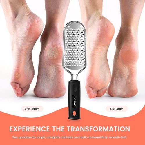 BEZOX Foot Scrubber for Dead Skin - Stainless Steel Heel Callus Foot File for Efficient Callus Removal - Foot Scraper Rasp for Smooth Feet (Dark)
