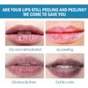 2pcs Lip Lightening for Dark Lips Lip Brightener for Smokers Dark Lip Treatment Lightening Cream for Pink Lips Lip Lightener for Smoker Lips Lip Lightening balm for Men and Women (Green)